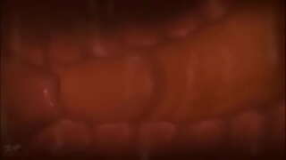 Са уложено материце